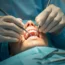 Oral Operations: What Patients Need to Know