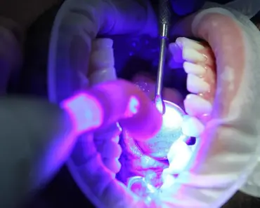 7 Best Affordable Whitening Strips Dentists Use and Recommend in 2026