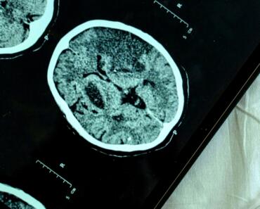 Best EHR for Mental Health: Key Features & Trends for 2026