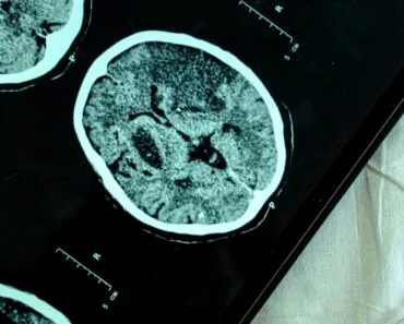 80 best ehr for mental health software on a tablet screen with 5ea2e46800
