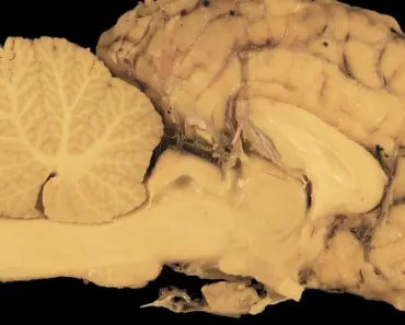 Mom Guilt Isn’t a Character Flaw—It’s Brain Science