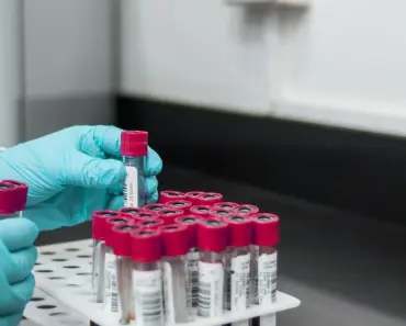 5 Blood Tests Every Woman Over 40 Should Know About