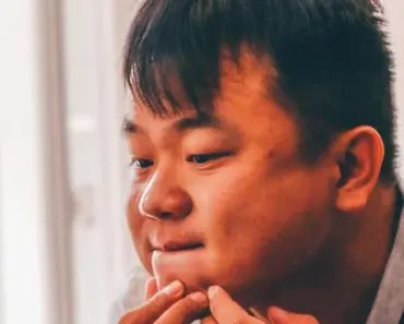 Is it Ok to Pop Comedonal Acne