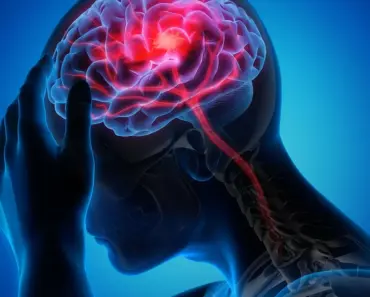 What Causes Migraines Its Not What Youd Expect