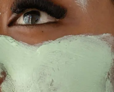 Why Are Blackheads Hard to Pop