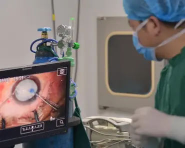 Do You Get Free Glasses After Cataract Surgery With Medicare