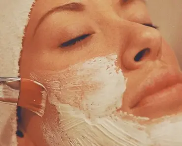 Who is Prone to Blackheads