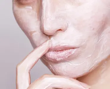 Will Blackheads Naturally Go Away