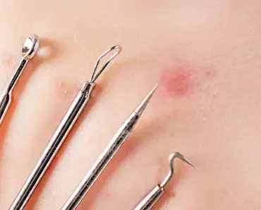 Can Pores Go Back to Normal Size