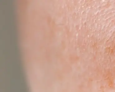 Does Toner Reduce Pores