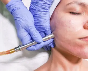 How Do I Stop My Pores From Refilling How Do I Stop My Pores From Refilling
