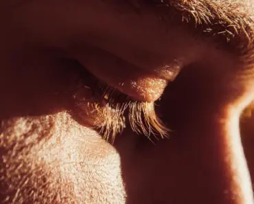 Does Squeezing Blackheads Damage Skin