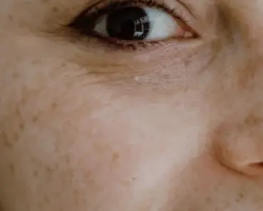 Which Acid is Best for Large Pores