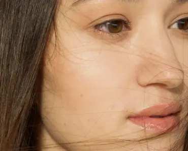 Does Squeezing Blackheads Increase Pore Size