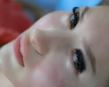 How Do Koreans Not Have Blackheads
