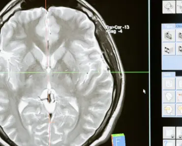 What is the Brain of a Car
