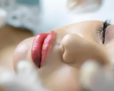 Does Benzoyl Peroxide Melt Blackheads