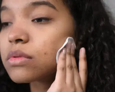 What Are the Tiny White Worms in My Pores