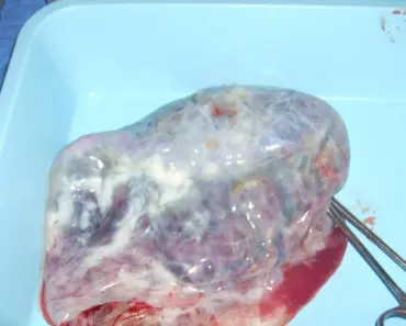 Postpartum Underwear that Help During the Fourth Trimester