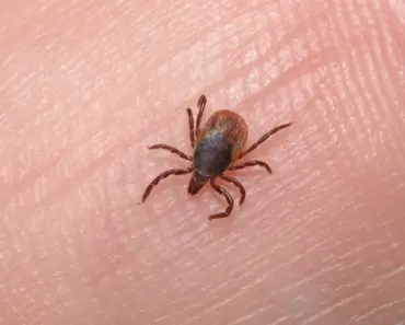 How to treat lice without losing your mind (from a mom who’s been there)